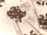 Stachybotrys chartarum (the black mould)